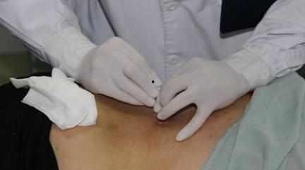 腱鞘炎视频,视频解析病因、症状及康复方法