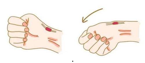 腱鞘炎视频,视频解析病因、症状及康复方法