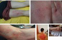 刮痧操作视频,轻松掌握家庭养生秘诀