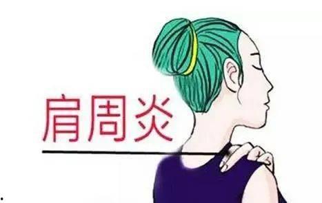肩周炎视频,视频教程带你轻松缓解疼痛