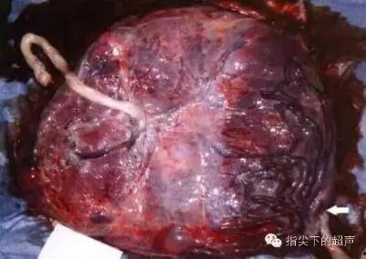 胎盘视频,孕育生命的神秘纽带