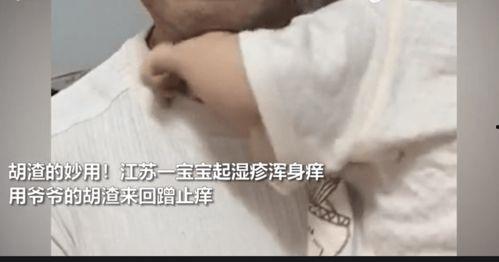 痒的视频,揭秘身体痒感的奥秘与应对策略