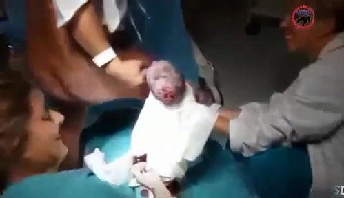 孕妇分娩正面视频,见证生命诞生的震撼时刻